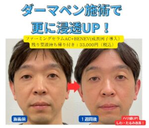 ファーミングセラムAC【ゼオスキン新製品】｜近鉄生駒駅の形成外科