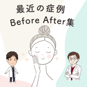 最近の症例Before After集